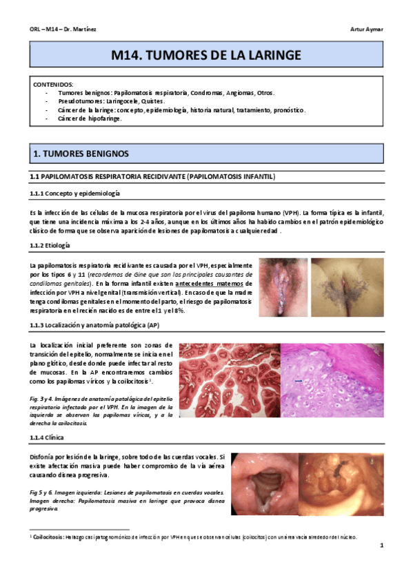 Miniatura del documento M14-TUMORES-DE-LARINGE-Caste.pdf