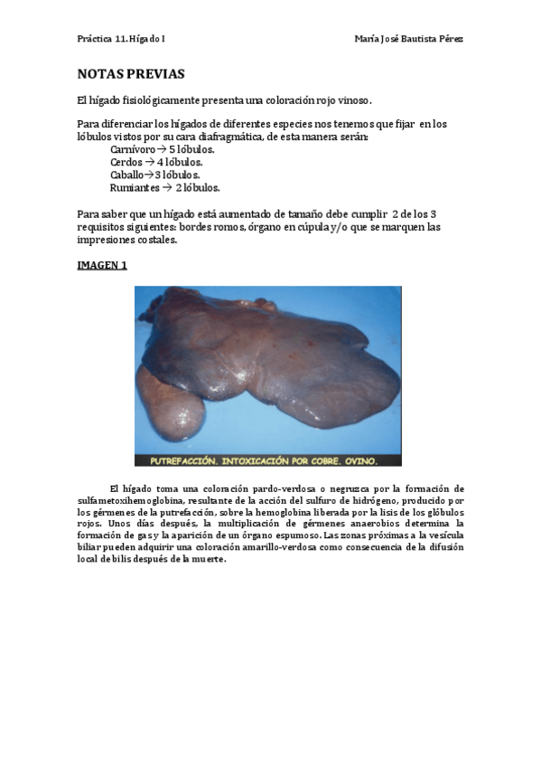 Miniatura del documento Práctica 11. Hígado I COMPLETA.pdf