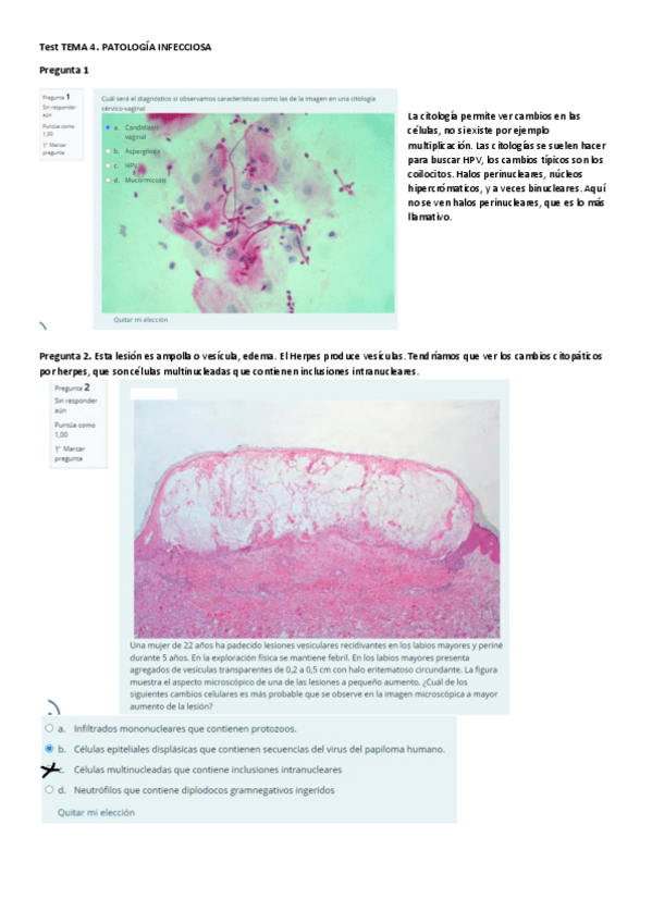 Miniatura del documento Test-Repaso-Tema-4.pdf