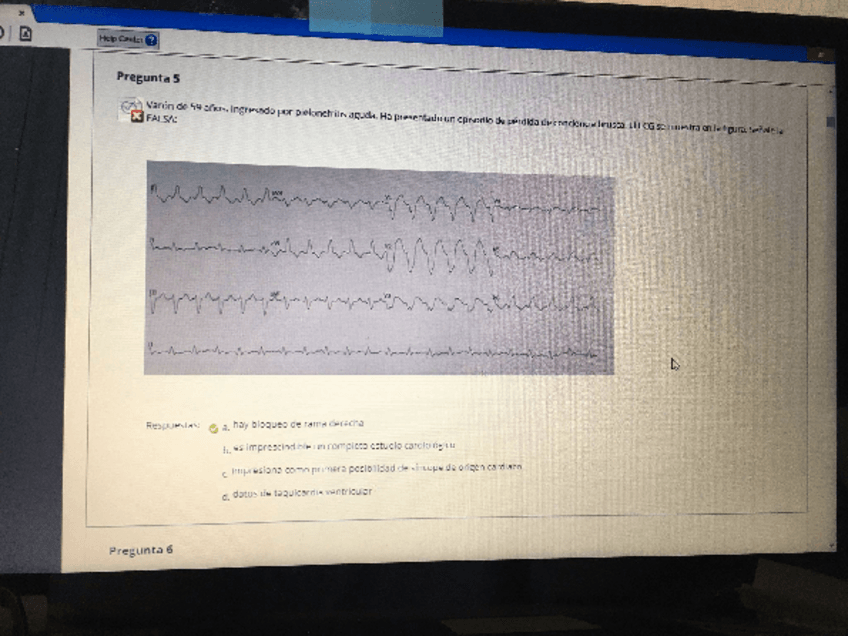 Miniatura del documento examen-fp.pdf