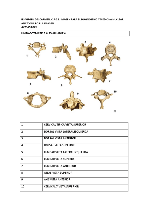 Miniatura del documento EVALUABLE-4-vertebras-RESUELTA16006b72e22f4b79b671b206899f9367.pdf