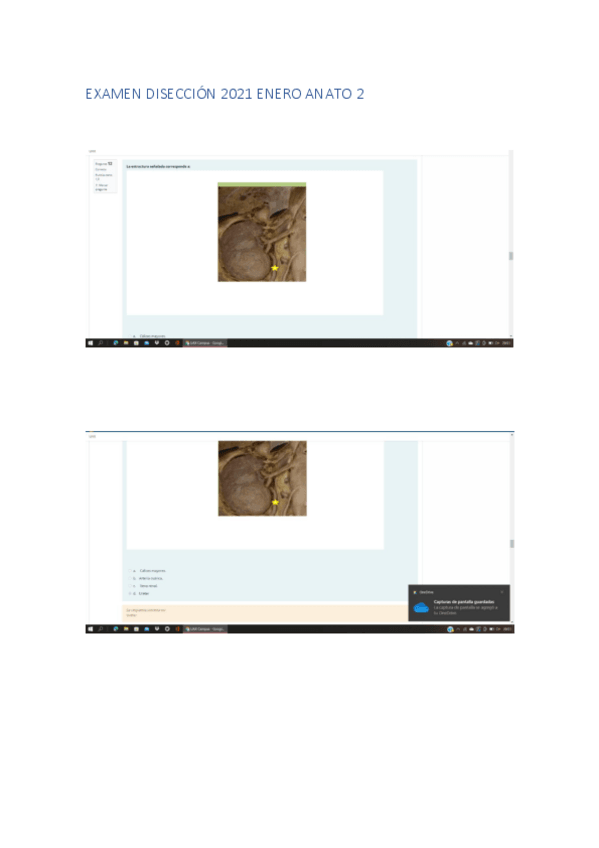 Miniatura del documento EXAMEN-DISECCION-2022-ENERO-ANATO-2.pdf