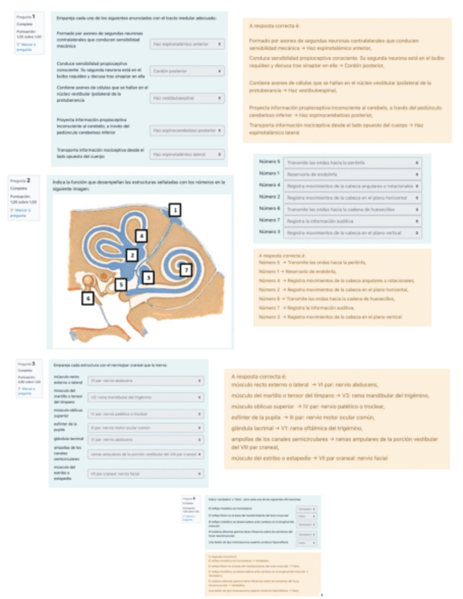 Miniatura del documento Neuroanatomia-Cuestinario-2-Medula-Espinal-Y-Organos-De-Los-Sentidos.pdf