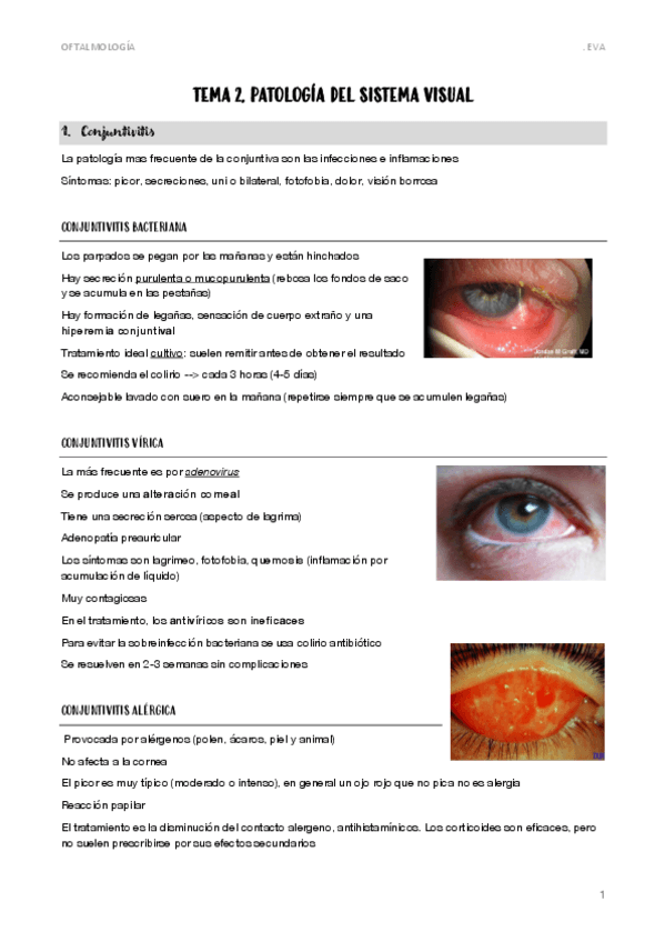 Miniatura del documento 2.-PATOLOGIA-DEL-SISTEMA-VISUAL.pdf