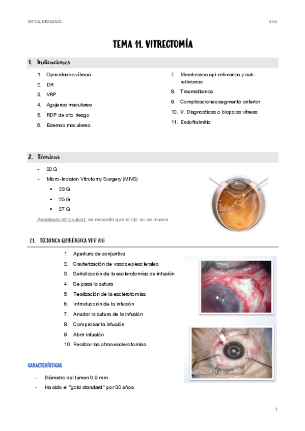 Miniatura del documento 11.-VITRECTOMIA.pdf