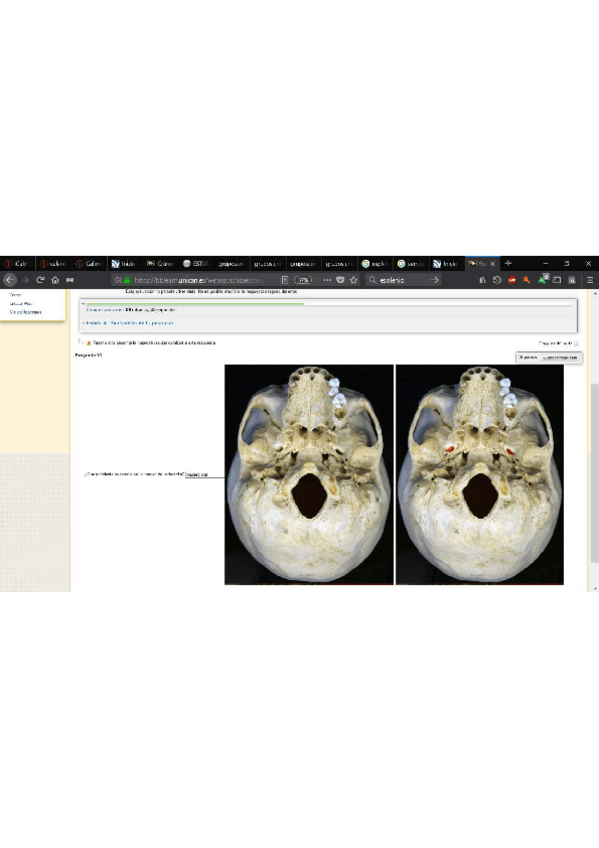 Miniatura del documento examen-imagenes-3.pdf