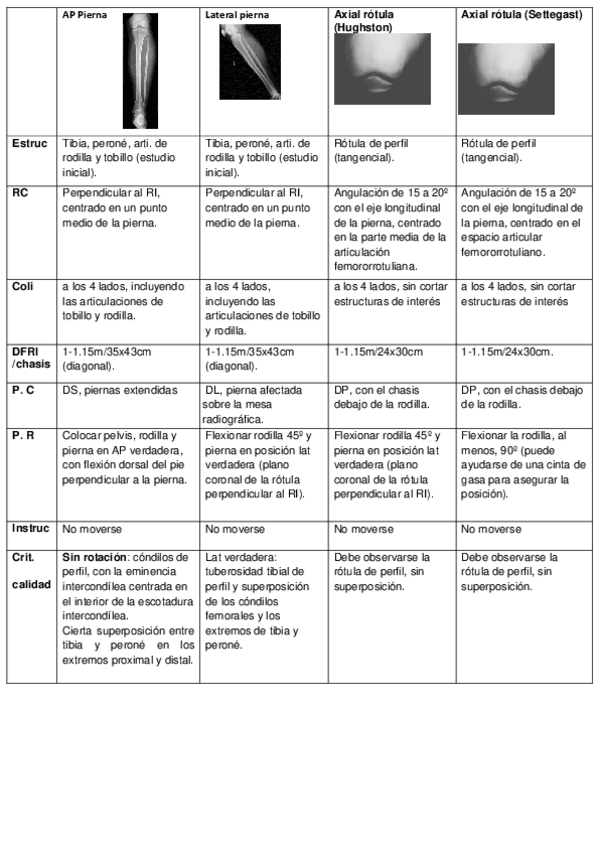 Miniatura del documento Proyecciones-Pierna-rodilla-femur-y-cadera.pdf
