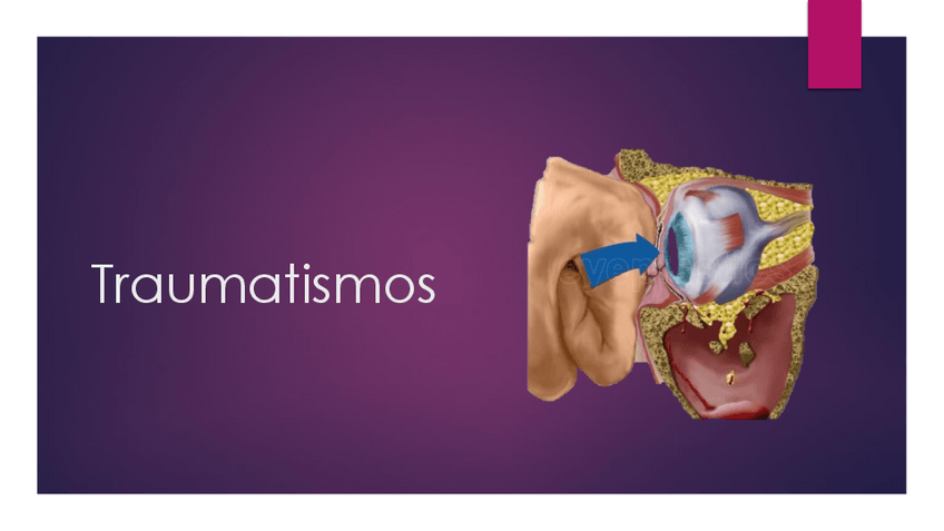 Miniatura del documento traumatismos.pdf