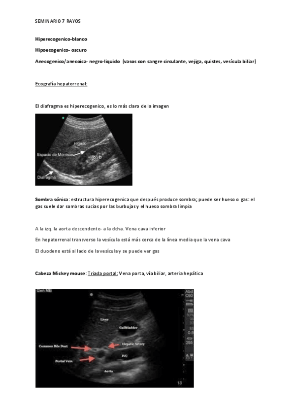 Miniatura del documento SEMINARIO-7-ECOGRAFIA-RADIOLOGICA.pdf
