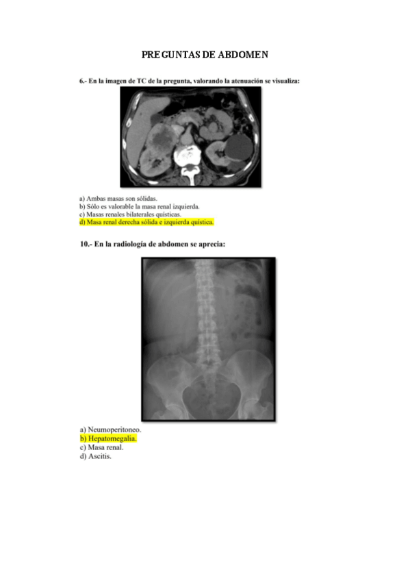Miniatura del documento preguntas-de-abdomen.pdf