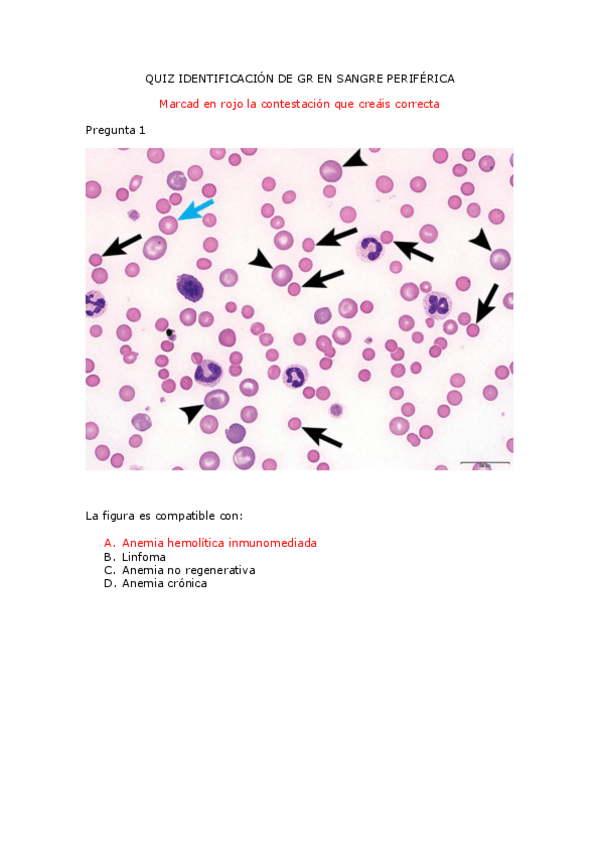 Miniatura del documento Practica-D-Globulos-Resuelta.pdf