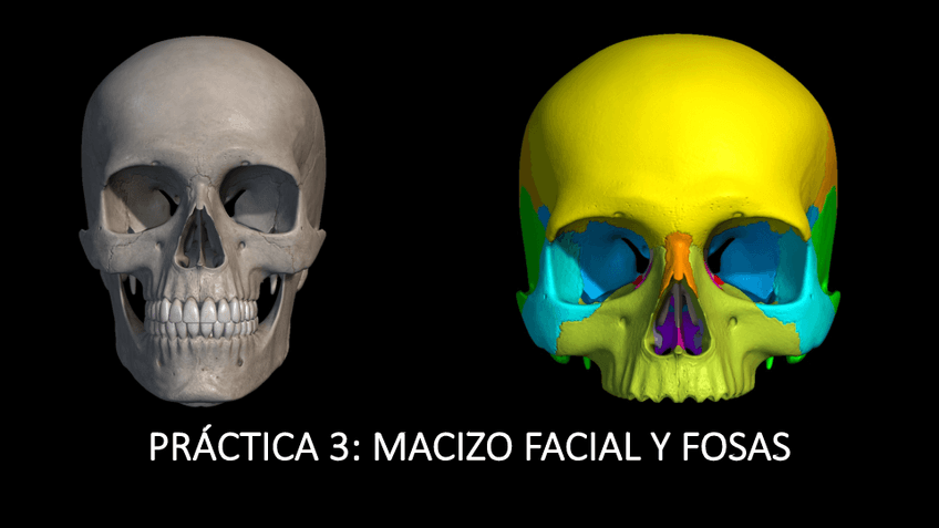 Miniatura del documento PRACTICA-3-VISIONES-LATERAL-Y-FRONTAL-FOSAS.pdf