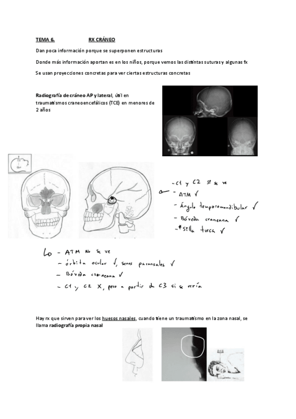 Miniatura del documento TEMA-6-3-CRANEO-Y-COLUMNA.pdf