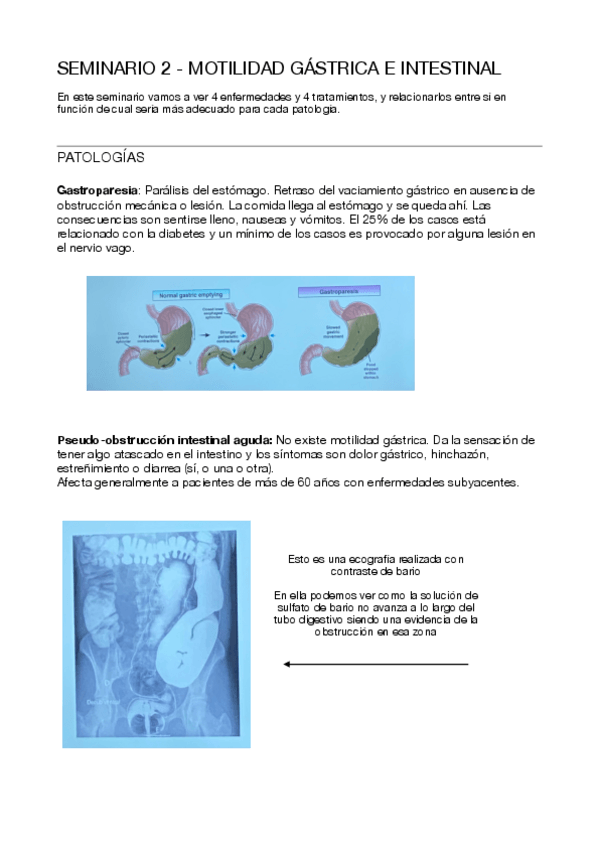 Miniatura del documento Seminario-2-Digestivo.pdf