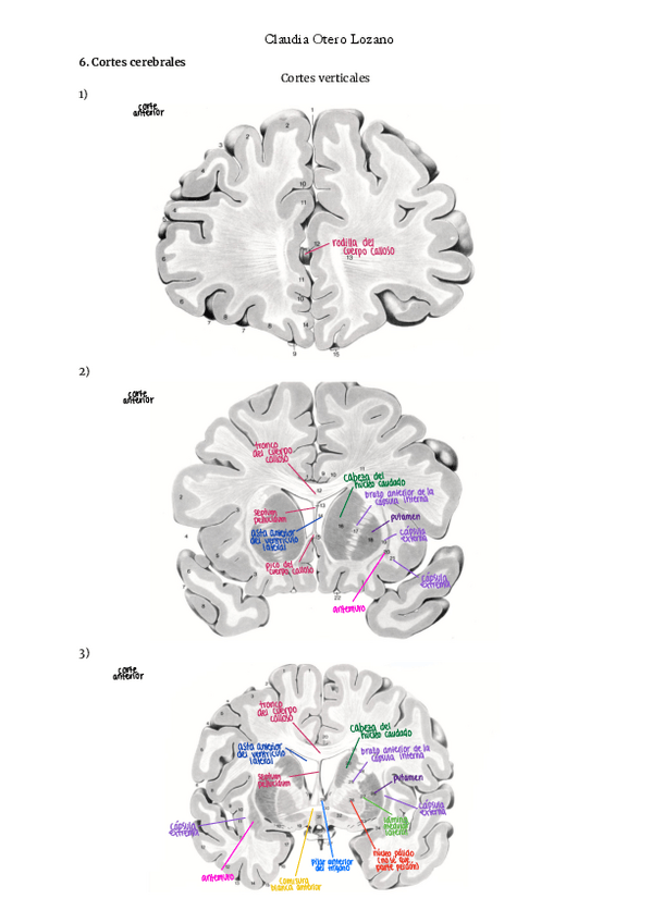 Miniatura del documento practicas-neuro-6y7-cortes-con-nombres.pdf