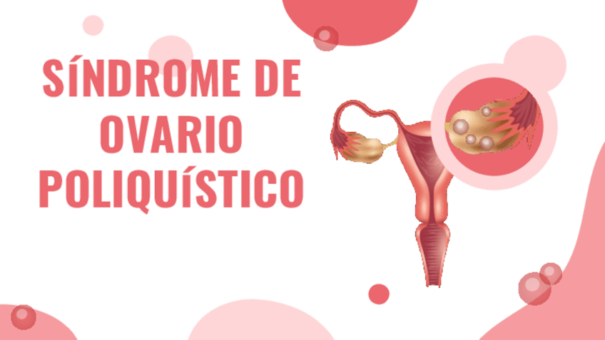 Miniatura del documento SOP.pdf