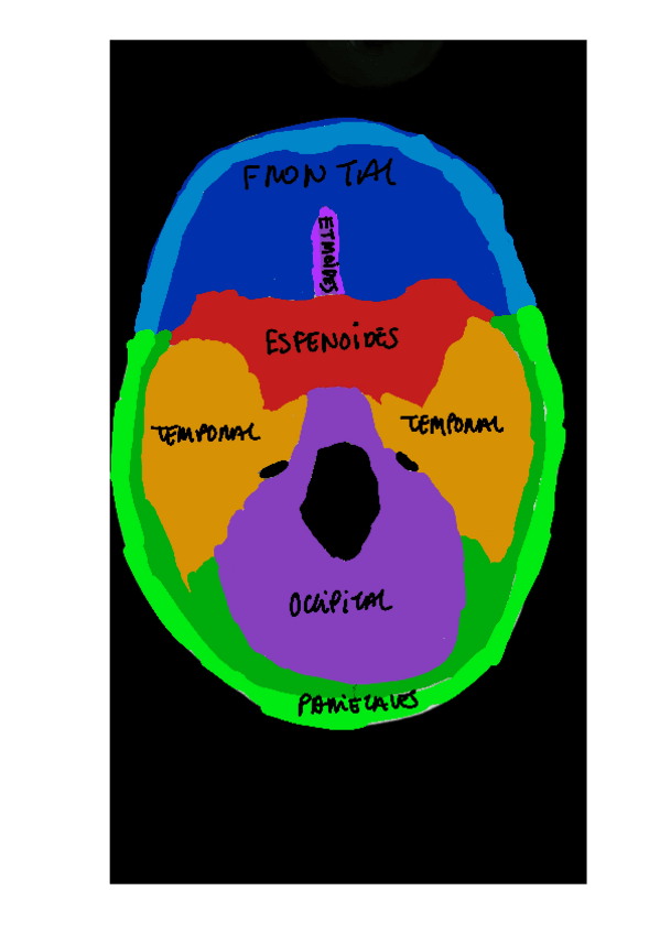 Miniatura del documento CRANEO-RESUELTO.pdf