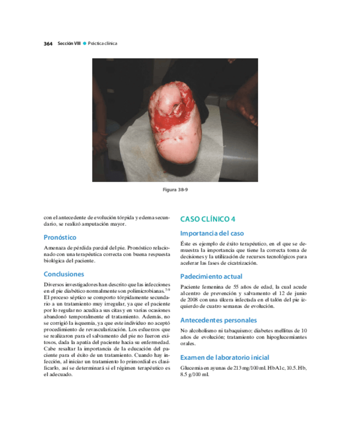 Miniatura del documento Pie-Diabetico-Atencion-Integral-S-28.pdf