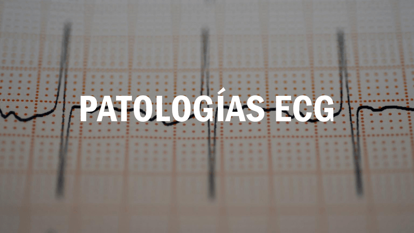 Miniatura del documento PATOLOGIAS-ECG-PRACTICA.pdf