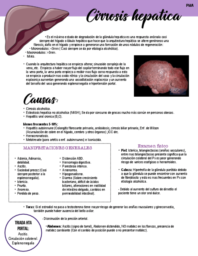 Miniatura del documento Cirrosis-hepatica.pdf