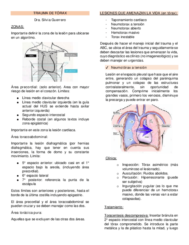 Miniatura del documento TRAUMA-DE-TORAX.pdf