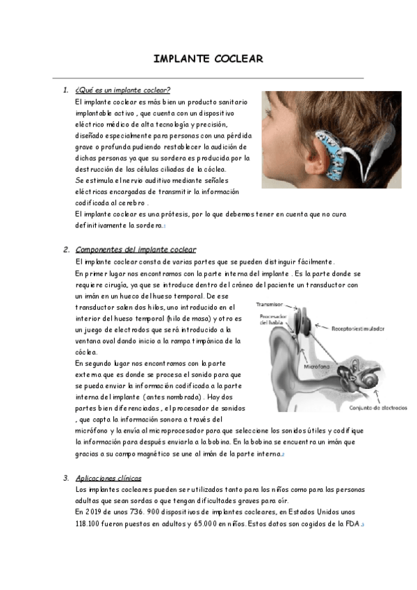 Miniatura del documento IMPLANTE-COCLEAR.pdf