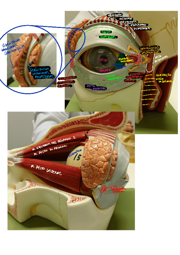 Miniatura del documento MODELO-OJO-RESUELTO.pdf