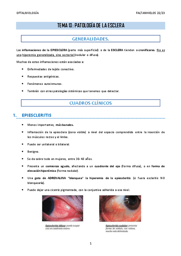Miniatura del documento 13.-Patologia-de-la-esclera.pdf