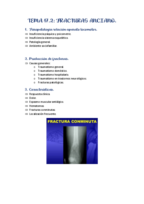 Miniatura del documento TEMA-17.2.pdf