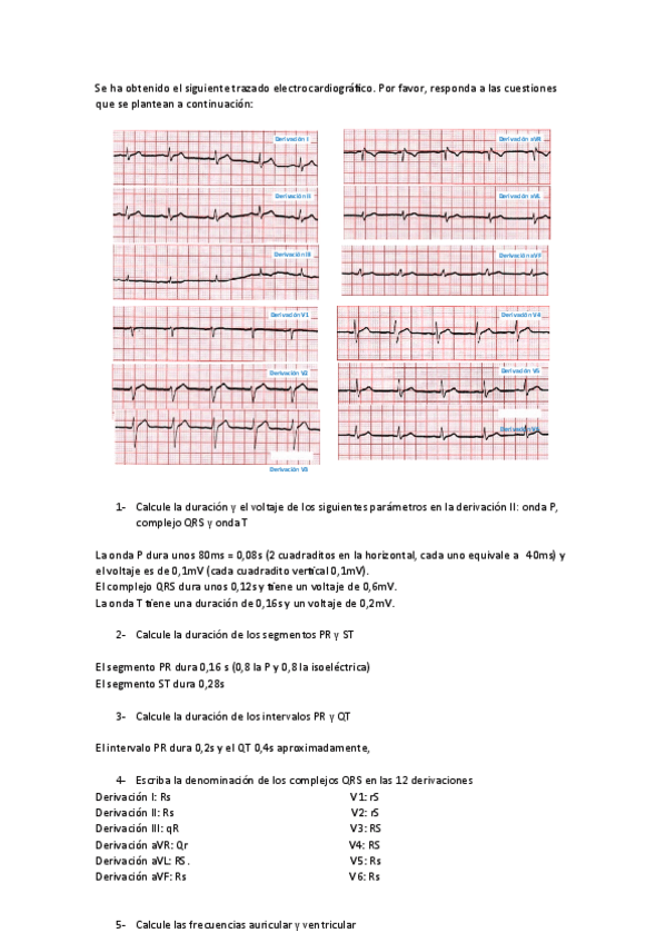 Miniatura del documento Ejercicio-ECG-practica.pdf