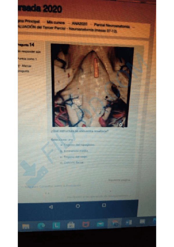 Miniatura del documento EXAMENES-ANATOMIA-PATOLOGICA-6.pdf