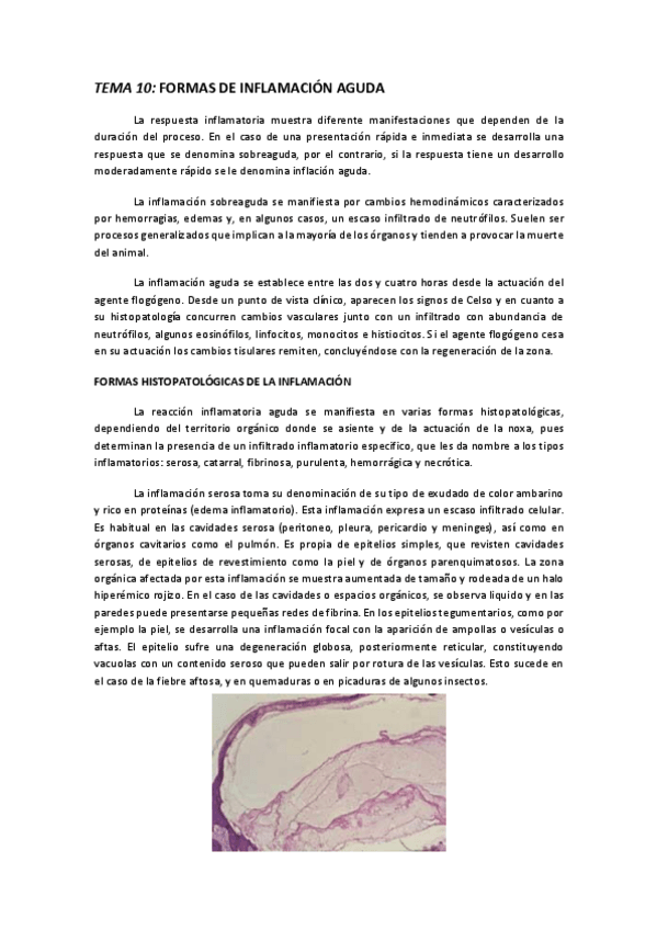 Miniatura del documento TEMA 10 FORMAS DE INFLAMACIÓN.pdf