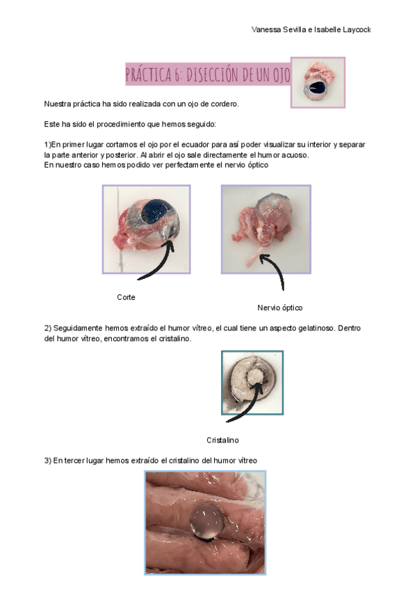 Miniatura del documento PRACTICA-6-DISECCION-DE-UN-OJO.pdf