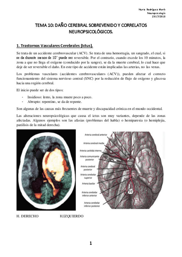 Miniatura del documento TEMA 10 NEURO.pdf