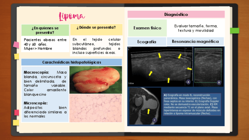 Miniatura del documento TUMORES-DE-PARTES-BLANDAS.pdf