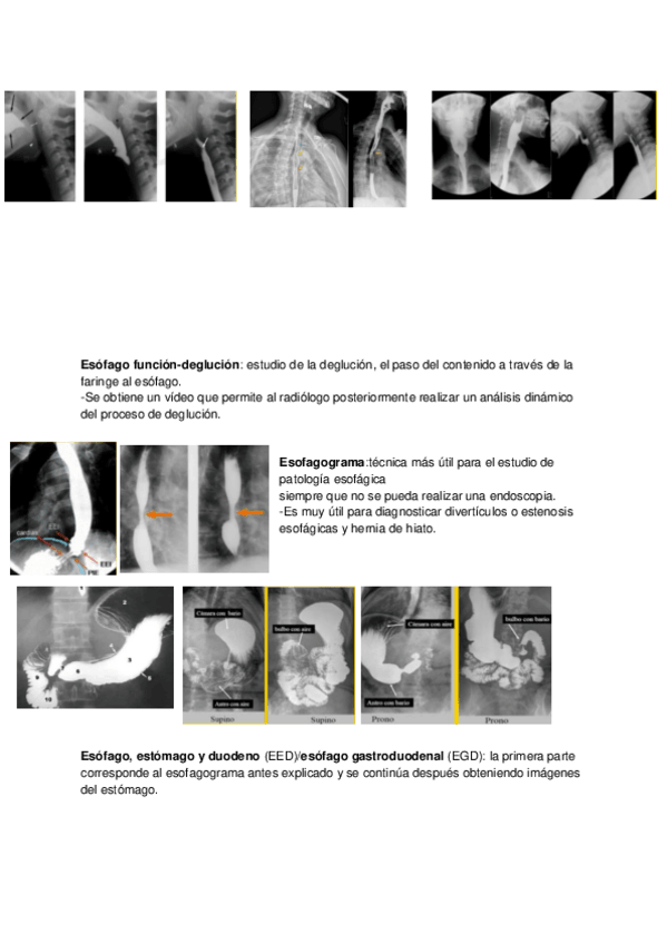 Miniatura del documento Subida-de-nota-Radiologia-Especial.pdf