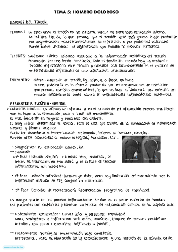Miniatura del documento Tema-5.-Hombro-doloroso.pdf