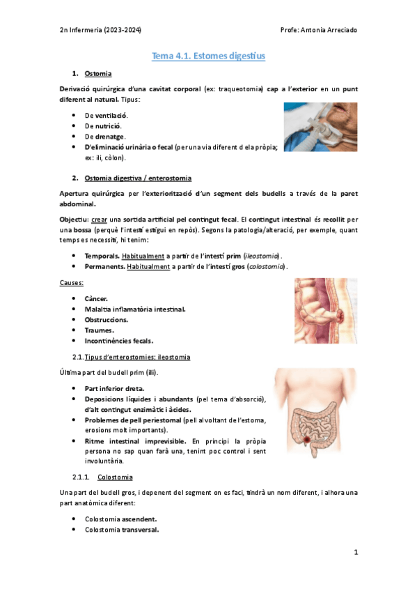 Miniatura del documento Tema-4.1.-Estomes-digestius.pdf