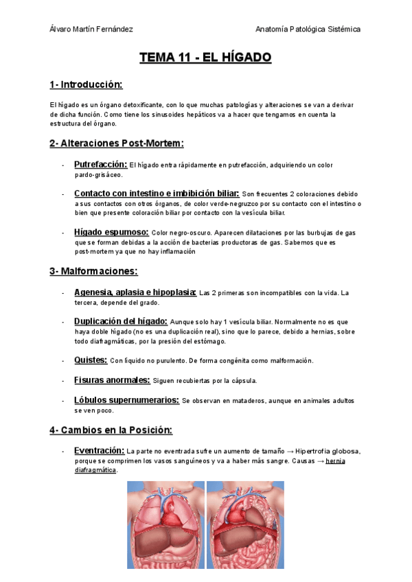 Miniatura del documento TEMA-11-EL-HIGADO.pdf