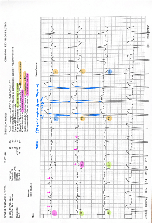 Miniatura del documento ECG-VARONA.pdf