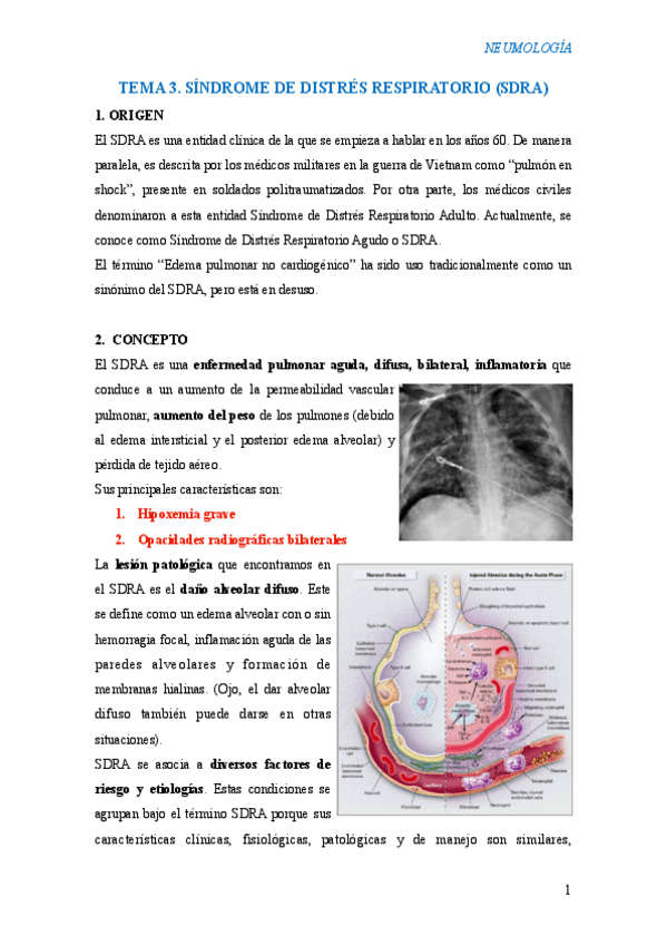 Miniatura del documento T3-SDRA.pdf