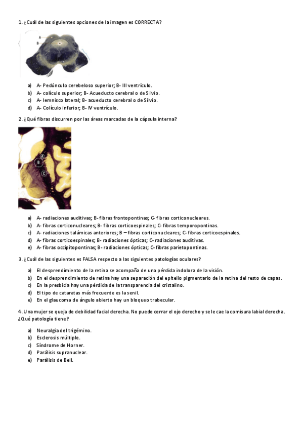 Miniatura del documento Examenes-2--solcuiones.pdf