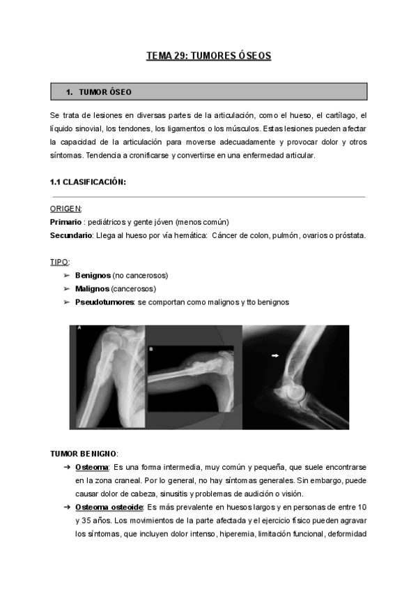 Miniatura del documento TEMA-29-TUMORES ÓSEOS.pdf