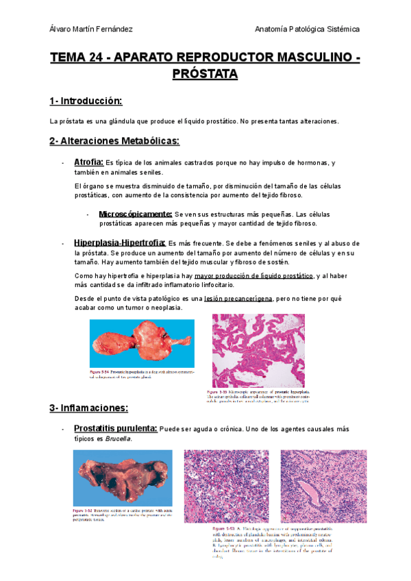 Miniatura del documento TEMA-24-APARATO-REPRODUCTOR-MASCULINO-PROSTATA.pdf