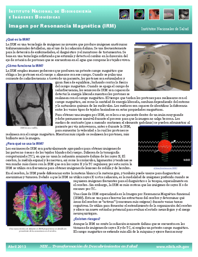 Miniatura del documento Imagen-por-Resonancia-Magnrtica-IRM.pdf