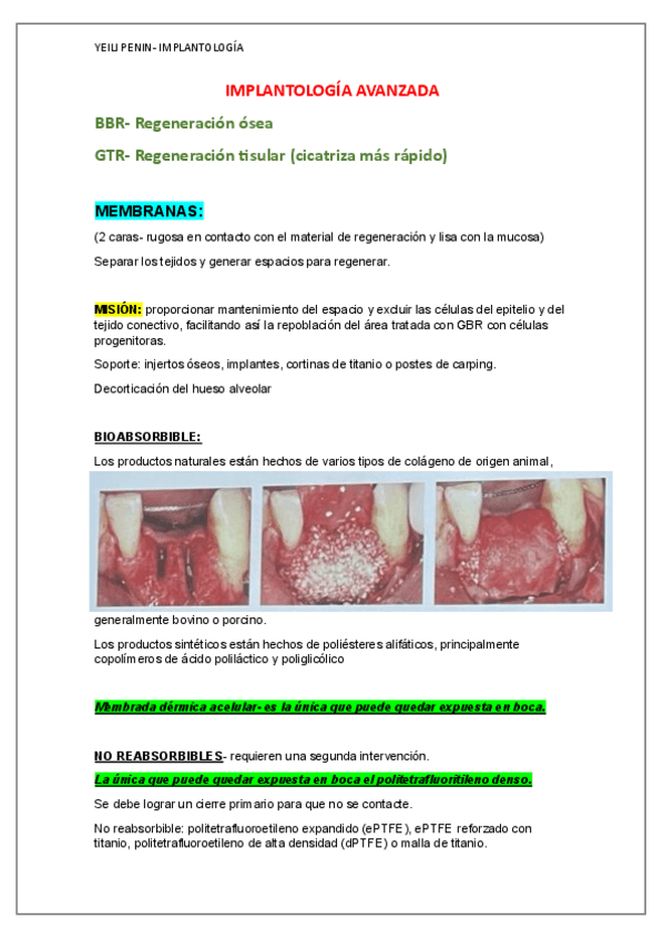 Miniatura del documento NUEVA-Implantologia-Avanzada-Prof.-Roberto.pdf