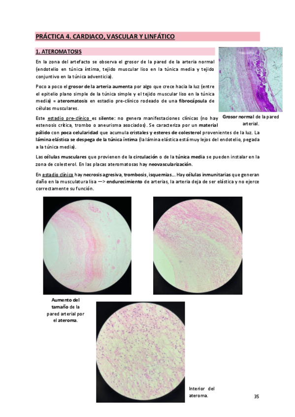 Miniatura del documento 4. Cardiaco, vascular y linfático.pdf