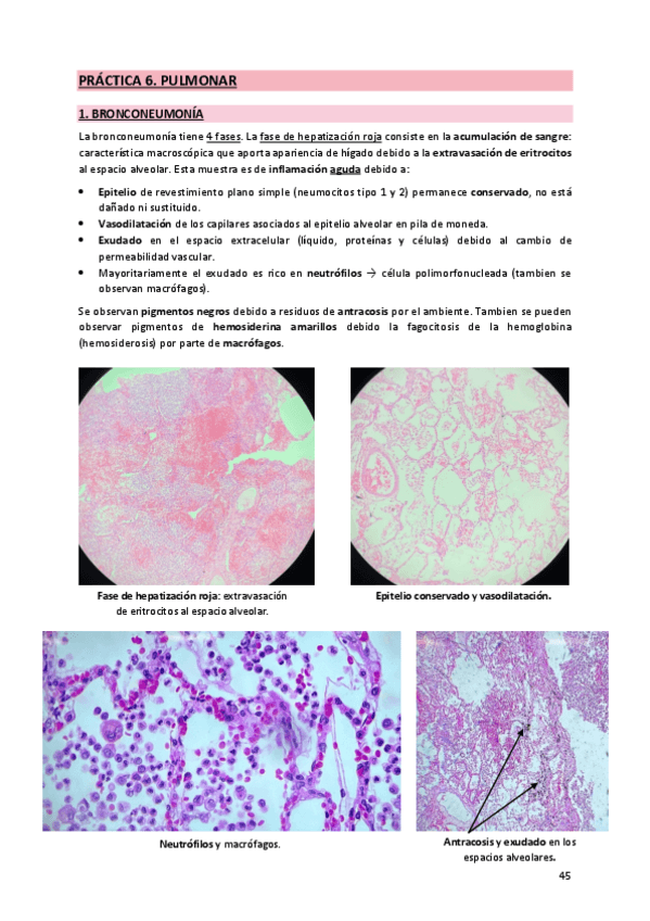 Miniatura del documento 6. Pulmonar.pdf