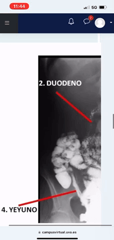 Miniatura del documento EXAMEN-2-ABDOMEN.mp4