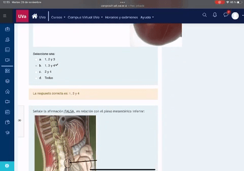 Miniatura del documento EXAMEN-3-ABDOMEN.mp4